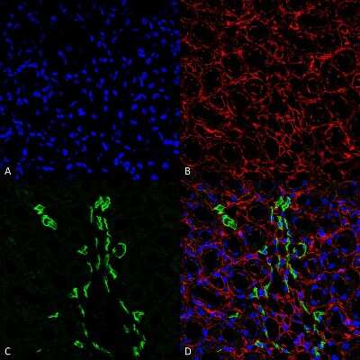 Immunohistochemistry: UT2/SLC14A2 Antibody [NBP1-44375]